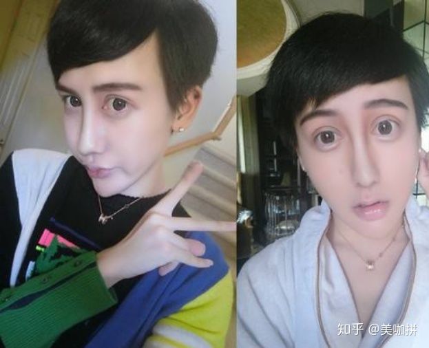 {娛樂城}(整容需要多少钱 男生)
